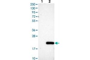 Western blot analysis of Lane 1: Negative control (vector only transfected HEK293T lysate), Lane 2: Over-expression Lysate (Co-expressed with a C-terminal myc-DDK tag (~3. (C11orf1 anticorps)