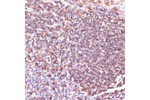 Immunohistochemistry of paraffin-embedded human tonsil using TPD52 antibody  at dilution of 1:100 (40x lens).