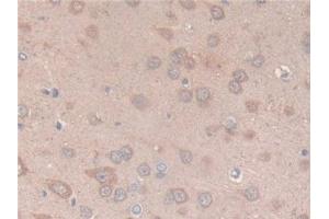 Detection of CS in Rat Brain Tissue using Polyclonal Antibody to Citrate Synthase (CS) (CS anticorps  (AA 56-312))