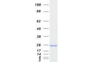 Validation with Western Blot