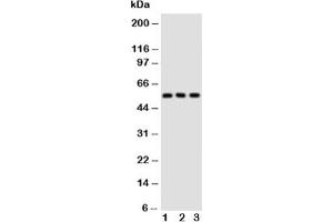 Western blot testing of GLUT5 antibody and Lane 1:  rat kidney;  2: rat liver;  3: mouse kidney tissue lysate (SLC2A5 anticorps  (Middle Region))