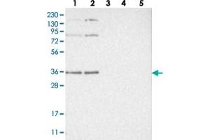Western blot analysis of Lane 1: RT-4, Lane 2: U-251 MG, Lane 3: Human Plasma, Lane 4: Liver, Lane 5: Tonsil with WRNIP1 polyclonal antibody  at 1:250-1:500 dilution. (WRNIP1 anticorps)