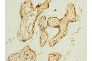 Immunohistochemistry of paraffin-embedded human placenta tissue using ABIN7175802 at dilution of 1:100 (WDR89 anticorps  (AA 1-387))