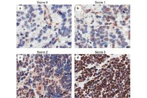 Immunohistochemistry results of Rabbit Anti-hCasz1 Antibody.