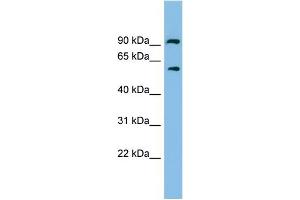 WB Suggested Anti-ALDH7A1 Antibody Titration: 0. (ALDH7A1 anticorps  (N-Term))