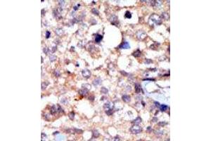 Image no. 2 for anti-C-Abl Oncogene 1, Non-Receptor tyrosine Kinase (ABL1) (C-Term) antibody (ABIN359966) (ABL1 anticorps  (C-Term))