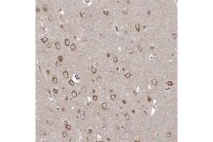 Immunohistochemical staining of human hippocampus with PPP2R3A polyclonal antibody  shows moderate cytoplasmic positivity in neuronal cells at 1:200-1:500 dilution. (PPP2R3A anticorps)