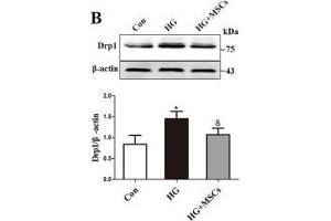 MSCs attenuate HG-induced mitochondrial dysfunction. (beta Actin anticorps  (AA 1-375))
