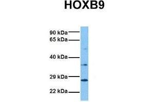 Host:  Rabbit  Target Name:  HOXB9  Sample Tissue:  Human Fetal Liver  Antibody Dilution:  1.
