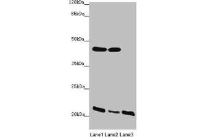 Western blot All lanes: ZDHHC16 antibody at 1. (ZDHHC16 anticorps  (AA 288-377))