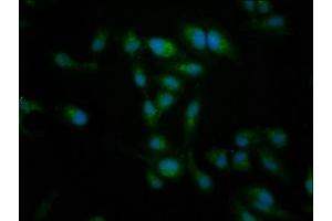 Immunofluorescence staining of Hela cells with ABIN7149425 at 1:266, counter-stained with DAPI.