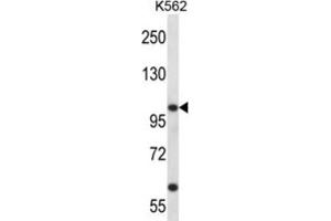Western Blotting (WB) image for anti-Potassium Voltage-Gated Channel, Shaw-Related Subfamily, Member 3 (KCNC3) antibody (ABIN2998065)