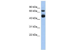 WB Suggested Anti-ALOX15 Antibody Titration: 0. (ALOX15 anticorps  (Middle Region))