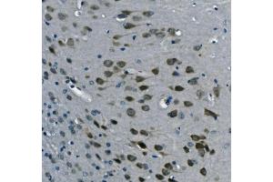 IHC analysis of PCBP2/hnRNP E2 using anti-PCBP2/hnRNP E2 antibody (ABIN7600449). (PCBP2 anticorps  (AA 197-276))