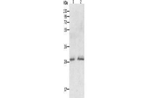 Gel: 12 % SDS-PAGE, Lysate: 60 μg, Lane 1-2: Human fetal liver tissue, hela cells, Primary antibody: ABIN7190766(GCH1 Antibody) at dilution 1/200, Secondary antibody: Goat anti rabbit IgG at 1/8000 dilution, Exposure time: 15 minutes