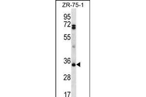 PDCD1LG2 Antibody (N-term) (ABIN656243 and ABIN2845559) western blot analysis in ZR-75-1 cell line lysates (35 μg/lane). (PDCD1LG2 anticorps  (N-Term))