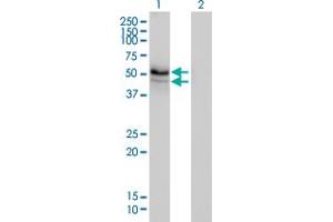 Western Blot analysis of HERPUD1 expression in transfected 293T cell line by HERPUD1 monoclonal antibody (M01), clone 3E10.