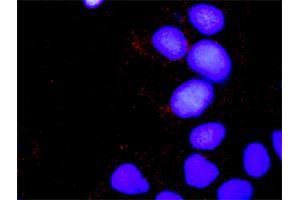 Proximity Ligation Analysis of protein-protein interactions between CRKL and SOS1.