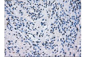 Immunohistochemical staining of paraffin-embedded liver tissue using anti-PSMA7mouse monoclonal antibody. (PSMA7 anticorps)
