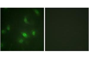Immunofluorescence analysis of HepG2 cells, using STAT5A/B (Phospho-Ser725/730) Antibody. (STAT5 A/B anticorps  (pSer726))