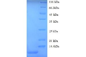 SDS-PAGE (SDS) image for GRO alpha Protein (GRO-A) (AA 29-96) protein (His tag) (ABIN5712662) (GRO alpha Protein (GRO-A) (AA 29-96) protein (His tag))