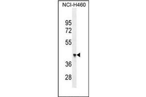 Western blot analysis of OXD4-like 1 Antibody (N-term) in NCI-H460 cell line lysates (35ug/lane). (FOXD4L1 anticorps  (N-Term))