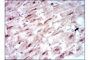 Immunohistochemistry (IHC) image for anti-Solute Carrier Family 2 (Facilitated Glucose Transporter), Member 4 (SLC2A4) (AA 224-353) antibody (ABIN1846354)