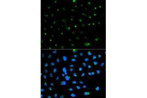 Immunofluorescence analysis of MCF7 cell using PSAP antibody. (Prosaposin anticorps  (AA 60-310))