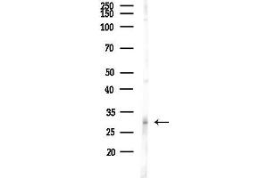 anti-TP53 induced glycolysis regulatory phosphatase (TIGAR) (Internal Region) antibody