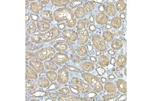Immunohistochemistry of paraffin-embedded rat kidney using IL11RA Rabbit mAb (ABIN7267984) at dilution of 1:150 (40x lens). (IL11RA anticorps)