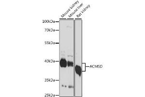 Western blot analysis of extracts of various cell lines, using ACMSD antibody (ABIN7265570) at 1:1000 dilution. (ACMSD anticorps  (AA 1-336))