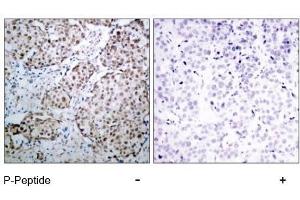Image no. 3 for anti-Tumor Protein P53 (TP53) (pSer315) antibody (ABIN196788) (p53 anticorps  (pSer315))