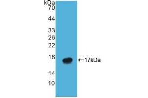 anti-ATPase, H+/K+ Exchanging, alpha Polypeptide (ATP4A) (AA 798-896) antibody