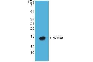 Detection of Recombinant ATP4a, Human using Polyclonal Antibody to ATPase, H+/K+ Exchanging Alpha Polypeptide (ATP4a) (ATP4A anticorps  (AA 798-896))