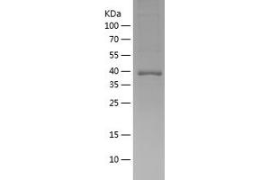 Western Blotting (WB) image for Calcium/calmodulin-Dependent Protein Kinase II delta (CAMK2D) (AA 2-115) protein (His-IF2DI Tag) (ABIN7122092)