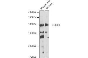 Western blot analysis of extracts of various cell lines, using DUOX1 antibody (ABIN6127816, ABIN6139857, ABIN6139858 and ABIN6224687) at 1:1000 dilution. (DUOX1 anticorps  (AA 1312-1551))