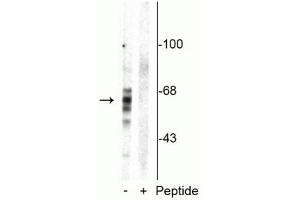 Western blot of rat brain homogenate showing specific immunolabeling of the ~59 kDa, ~65 kDa, ~68 kDa Tau isoforms phosphorylated at Ser416 in the first lane (-). (MAPT anticorps  (pSer416))