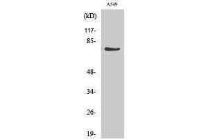 Western Blotting (WB) image for anti-Guanylate Cyclase 1 Soluble Subunit Alpha (GUCY1A1) (Internal Region) antibody (ABIN3175251) (GUCY1A1 anticorps  (Internal Region))