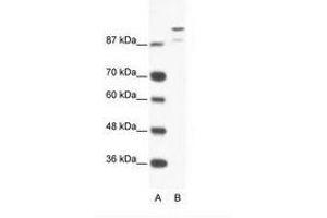 Image no. 1 for anti-HKR1, GLI-Kruppel Zinc Finger Family Member (HKR1) (AA 191-240) antibody (ABIN202856) (HKR1 anticorps  (AA 191-240))