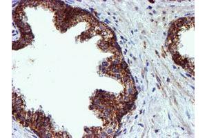 Image no. 8 for anti-NADH Dehydrogenase (Ubiquinone) 1 beta Subcomplex, 9, 22kDa (NDUFB9) (AA 3-179) antibody (ABIN1491359)