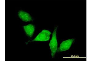 Immunofluorescence of purified MaxPab antibody to HDAC6 on HeLa cell. (HDAC6 anticorps  (AA 1-1215))