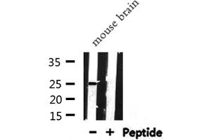 Western blot analysis of APOA1 expression in Mouse brain lysate