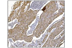 IHC analysis of NDEL1 using anti-NDEL1 antibody (ABIN7602511). (NDEL1 anticorps  (AA 80-320))