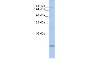 WB Suggested Anti-UBR2 Antibody Titration:  0. (UBR2 anticorps  (C-Term))