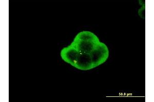 Immunofluorescence of monoclonal antibody to C1orf19 on MCF-7 cell.