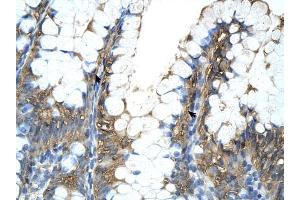 PPIA antibody was used for immunohistochemistry at a concentration of 4-8 ug/ml to stain Epithelial cells of intestinal villus (arrows) in Human Intestine.