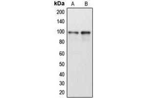 Western blot analysis of DDX54 expression in HeLa (A), Jurkat (B) whole cell lysates. (DDX54 anticorps  (Center))