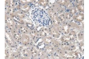 Detection of PINP in Human Kidney Tissue using Monoclonal Antibody to Procollagen I N-Terminal Propeptide (PINP)