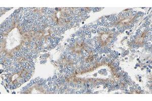 ABIN6275145 at 1/100 staining Human prostate tissue by IHC-P. (GCP6 anticorps  (Internal Region))