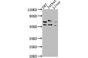 Western Blot Positive WB detected in: U87 whole cell lysate, Jurkat whole cell lysate, Rat liver tissue All lanes: CDK5RAP3 antibody at 1:1000 Secondary Goat polyclonal to rabbit IgG at 1/50000 dilution Predicted band size: 57, 47, 32, 60 kDa Observed band size: 57 kDa (CDK5RAP3 anticorps  (Regulatory Subunit))